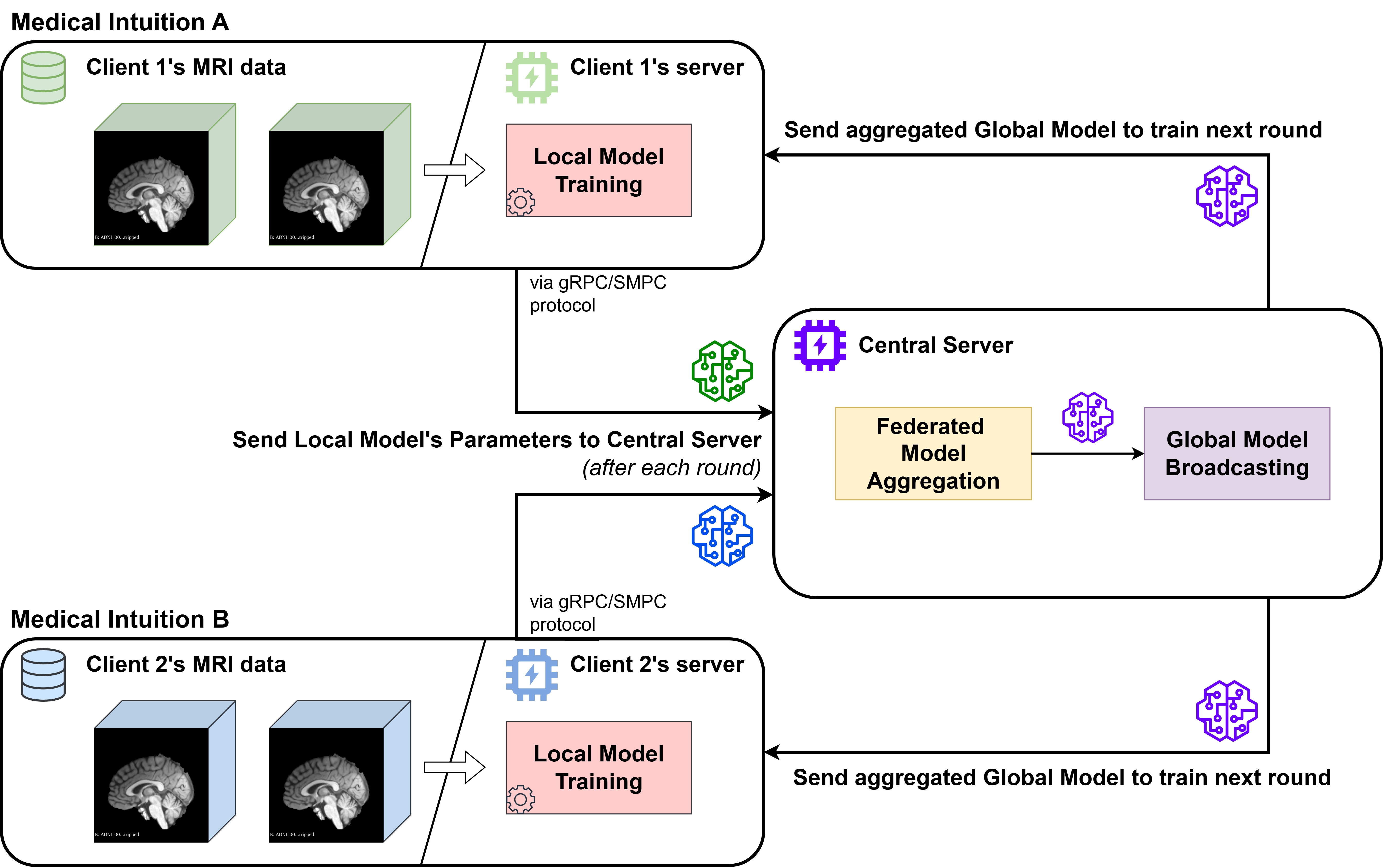 FL Alzheimer's Classification